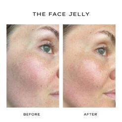The Face Jelly -Ffs Sales Store BEFORE AFTER THE FACE JELLY